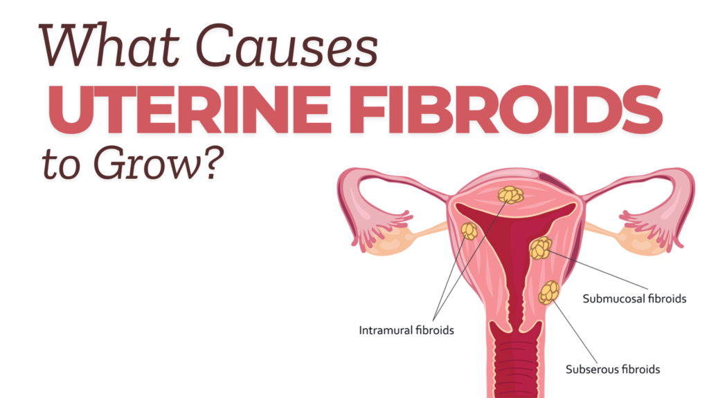 What Causes Uterine Fibroids to Grow?